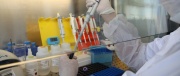 Ученые-генетики СВФУ получили патент РФ на перспективное изобретение в области геномной медицины